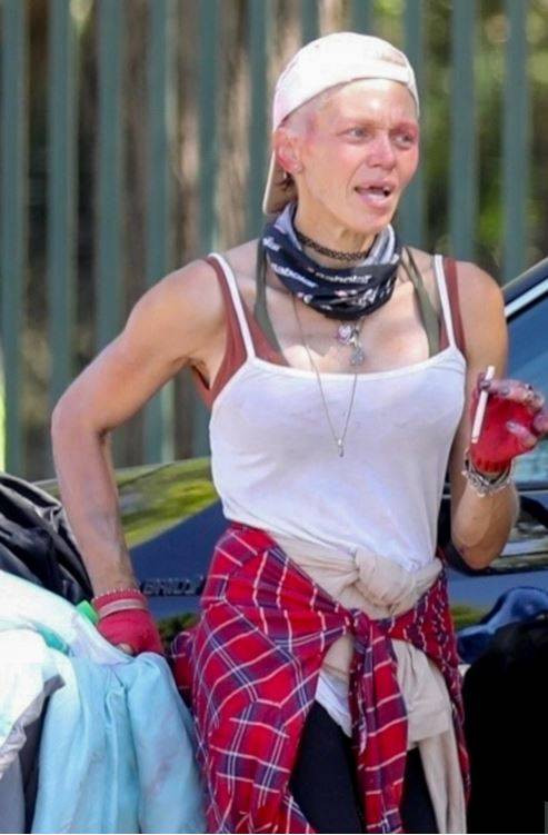 Ünlü model Loni Willison ön dişleri dökük yine çöp toplarken görüntülendi - Resim: 18